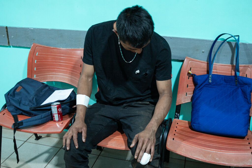 G. Kaiowá, de 23 anos, que levou um tiro de borracha no peito e em um dos dedos durante o ataque. Foto: Gabriel Schlickmann